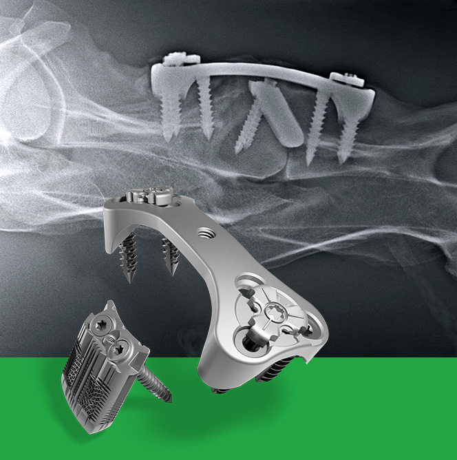 Cervical arthrodesis C2-C6 for adult horses