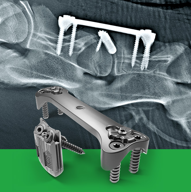 Cervical arthrodesis for foals